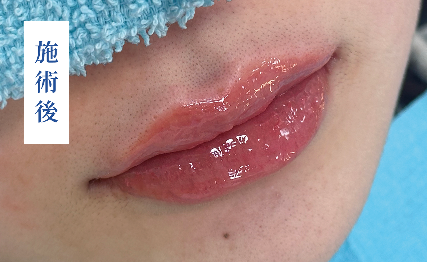 リップアートメイク After